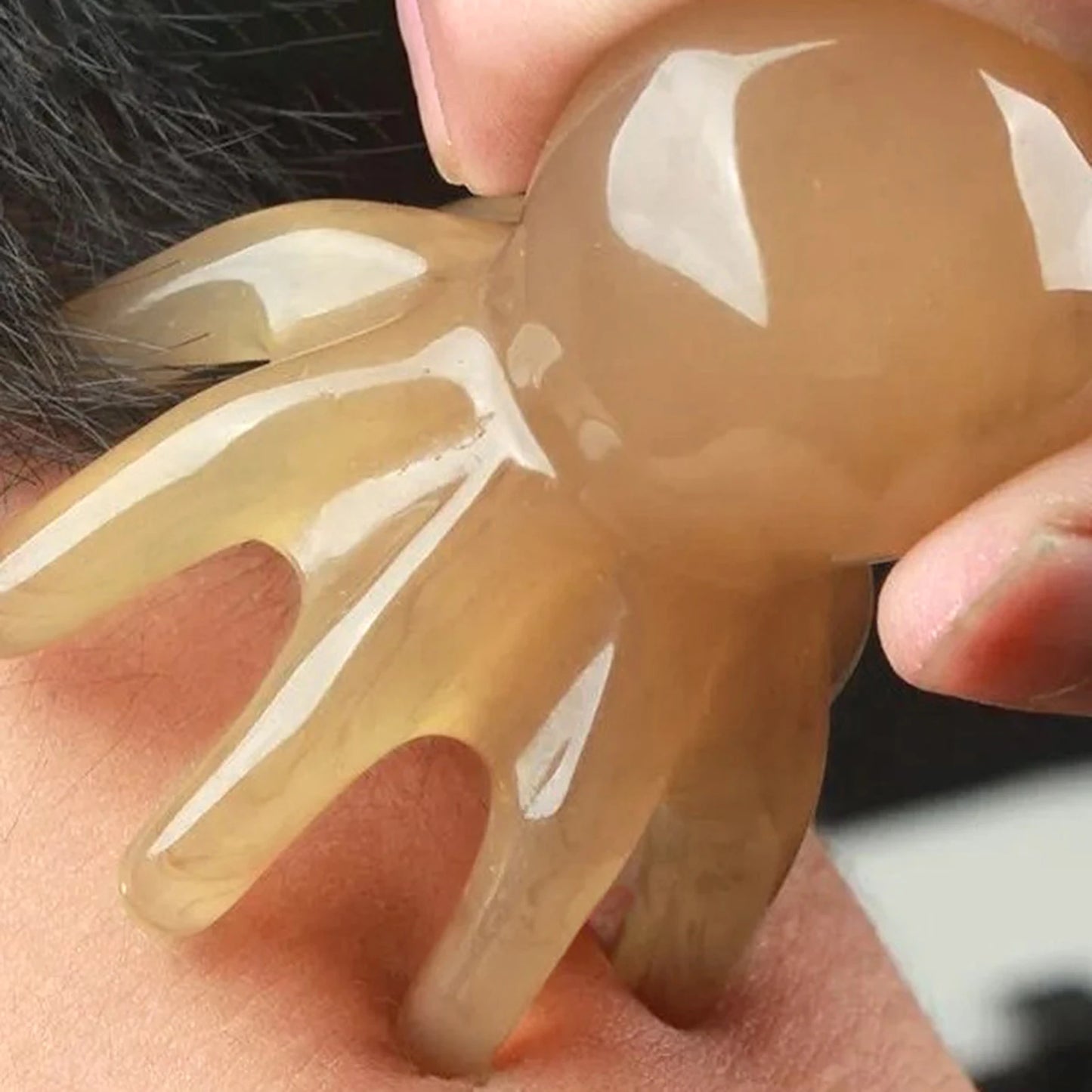 De octo hoofdhuid Guasha