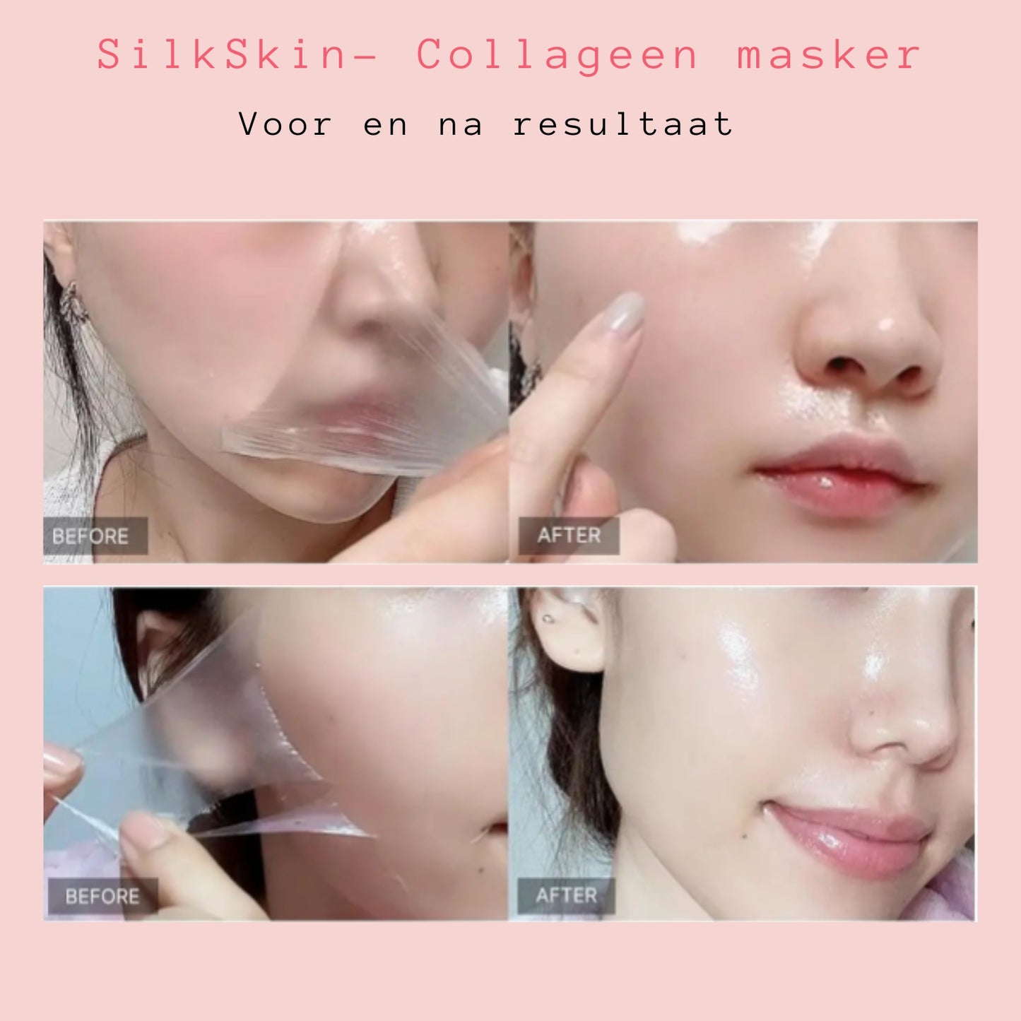 SilkSkin - Collageen masker